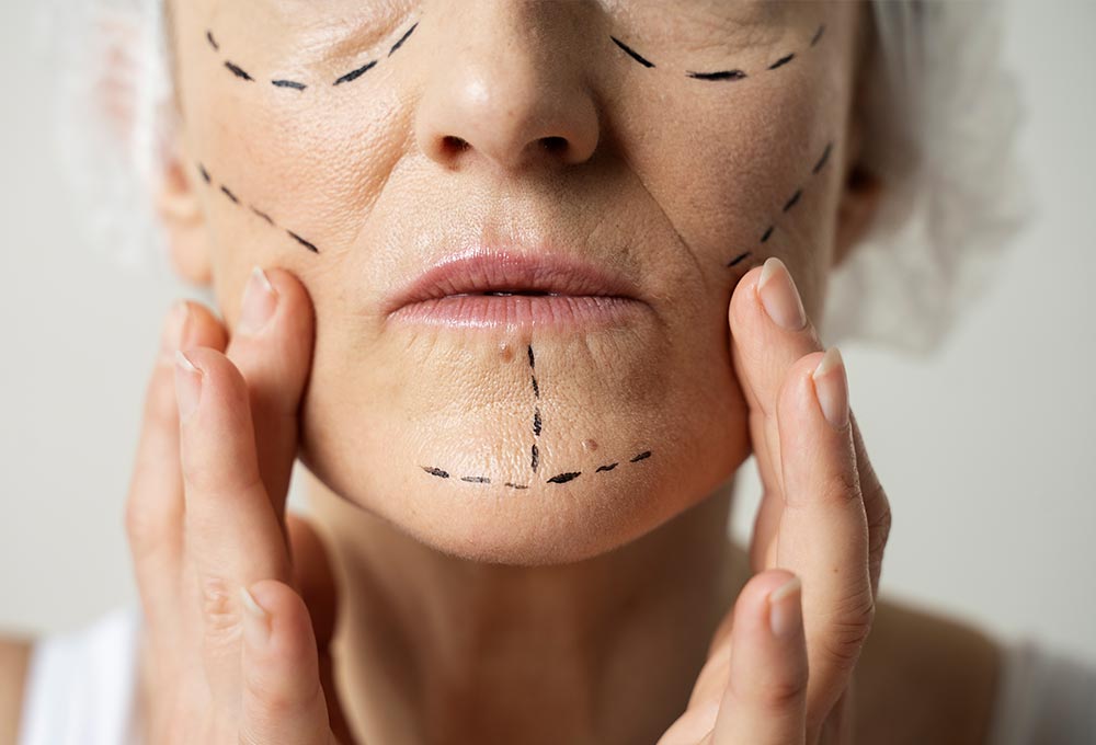 Reveal a new you confidence through surgery and radiate confidence (Demo)